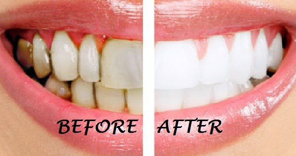 Coconut oil is a great teeth cleanser